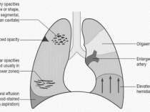 Emergency Medicine | Epomedicine