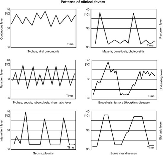 types-of-fever