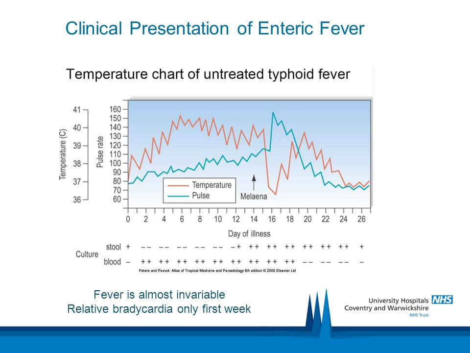 relative-bradycardia-epomedicine