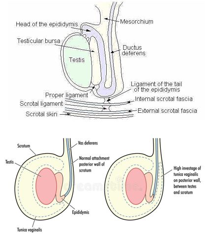 Increased mobility of testis. 