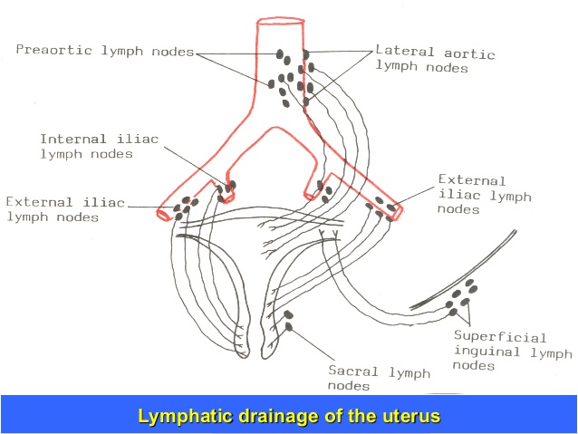 lymphatic draiange of uterus