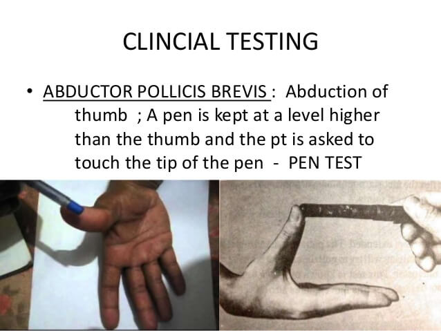 abductor pollicis brevis test