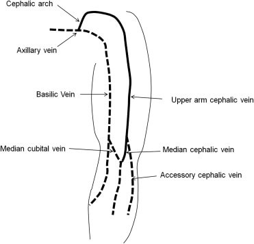 superficial vein forearm