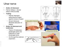 Ulnar nerve - Course and Innervation | Epomedicine