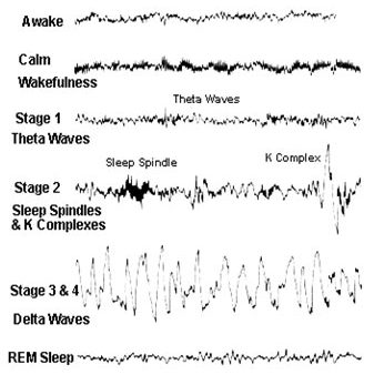 Multiple Sclerosis Mnemonic | Epomedicine