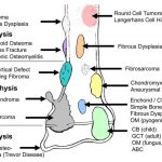 Carpal Bones Ossification: Mnemonic | Epomedicine