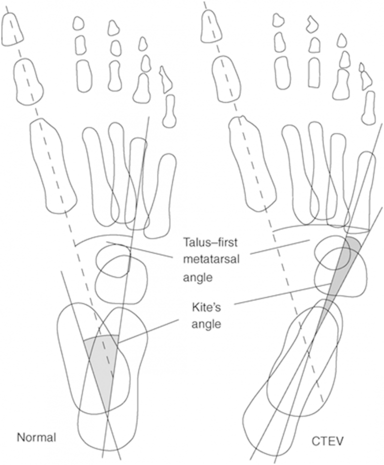 Lines and Angles in Orthopedics Epomedicine
