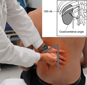 renal angle tenderness