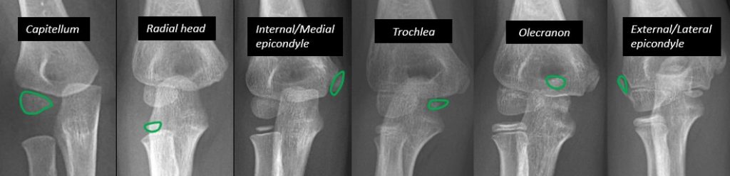 ossification center elbow