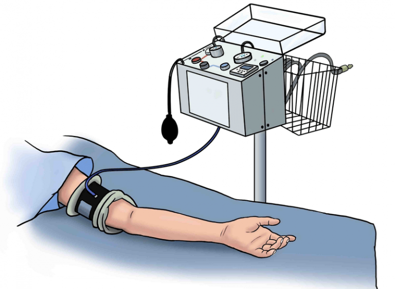 Bruner’s Ten Rules of Pneumatic Tourniquet Use Epomedicine