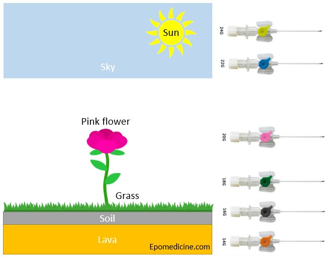 iv cannula sizes and color and uses