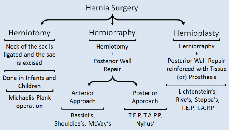 Hernia Inguinal Hernia Epomedicine