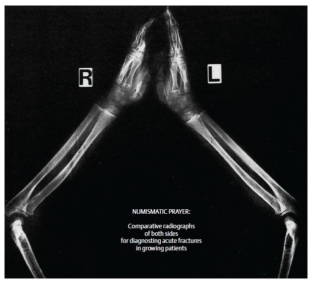 numismatic prayer radiograph