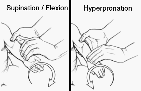 Pulled elbow reduction | Epomedicine