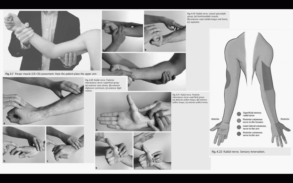 radial nerve examination