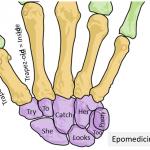 Brown-Sequard Syndrome - Anatomical Basis | Epomedicine