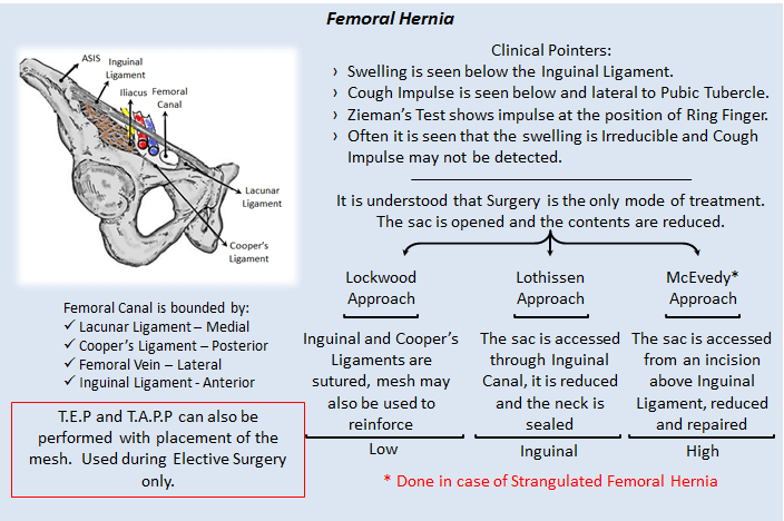 femoral hernia