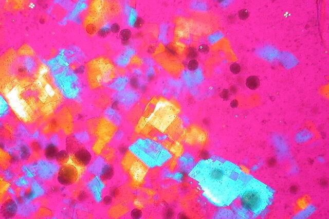 polarized microscopy