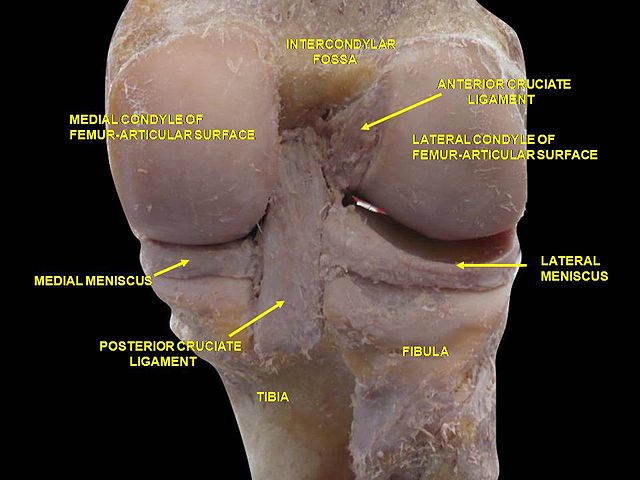 sulcus terminalis lateral femoral condyle