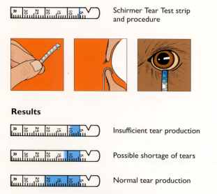 schirmer test