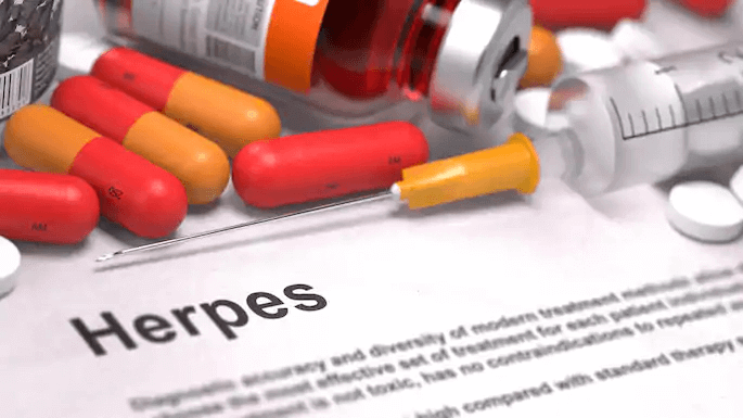 herpes myths
