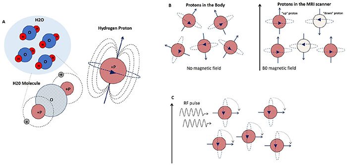 MRI Physics Made Easy | Epomedicine