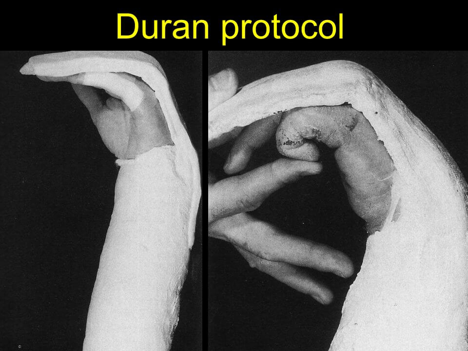 Duran protocol