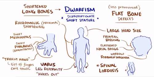 symptoms of achondroplasia