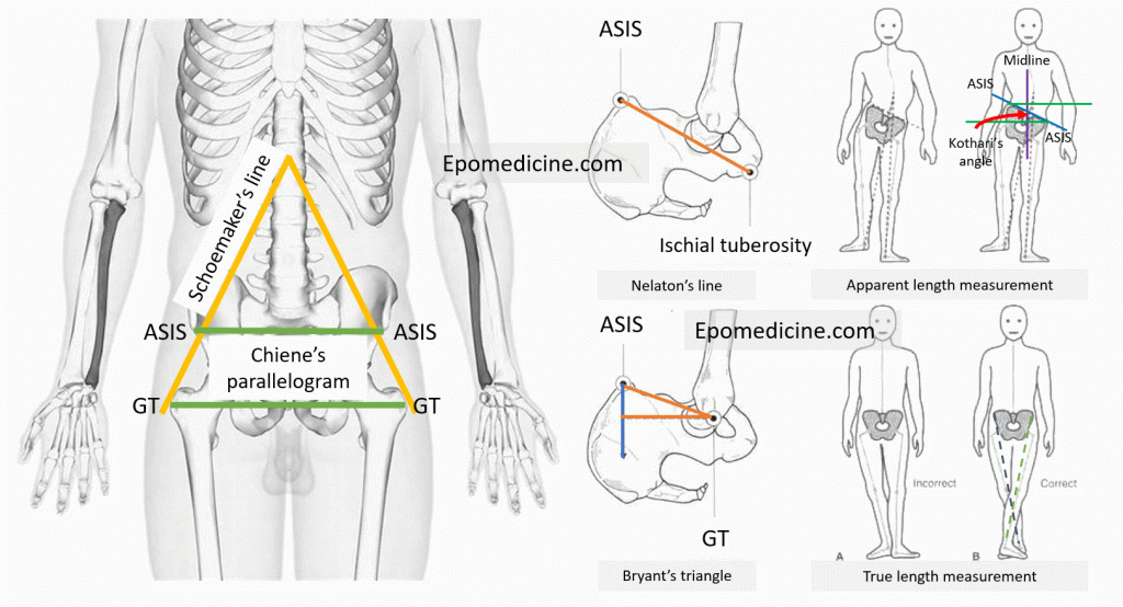 hip examination