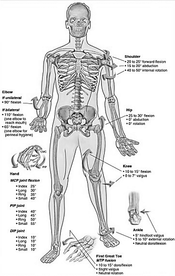 Arthrodesis Positions | Epomedicine