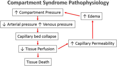 compartment syndrome vicious cycle