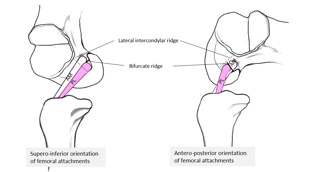 Cruciate Ligaments Of Knee Mnemonics Epomedicine