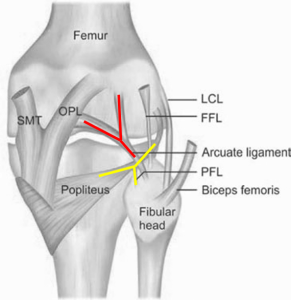 Posterolateral corner (PLC) of knee | Epomedicine