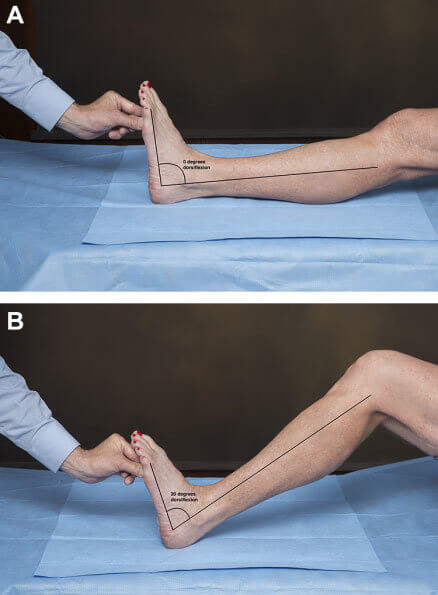 Ankle Plantar Flexion / Dorsiflexion, Standing