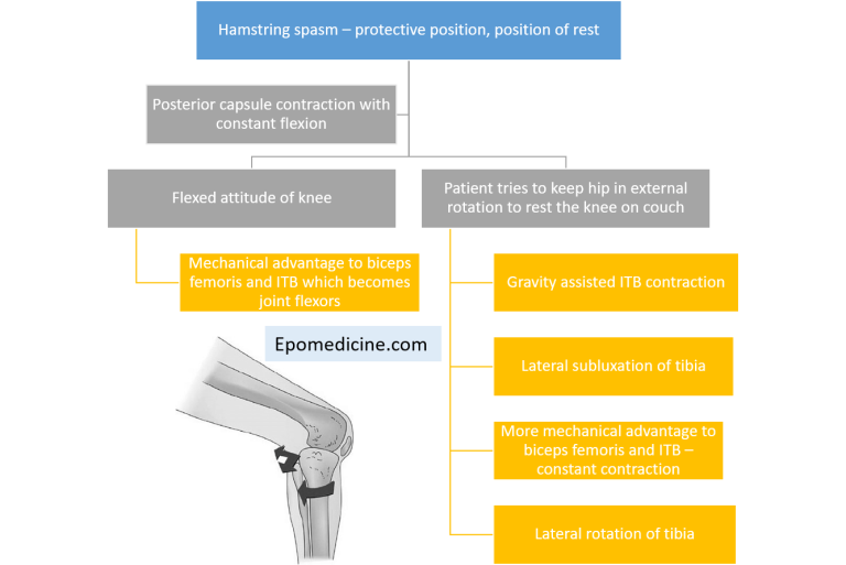 Triple Deformity Of Knee Mnemonic Epomedicine triple-deformity-of-knee-mnemonic-epomedicine
