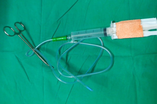 Syringe Suction Vacuum Drain : Technique