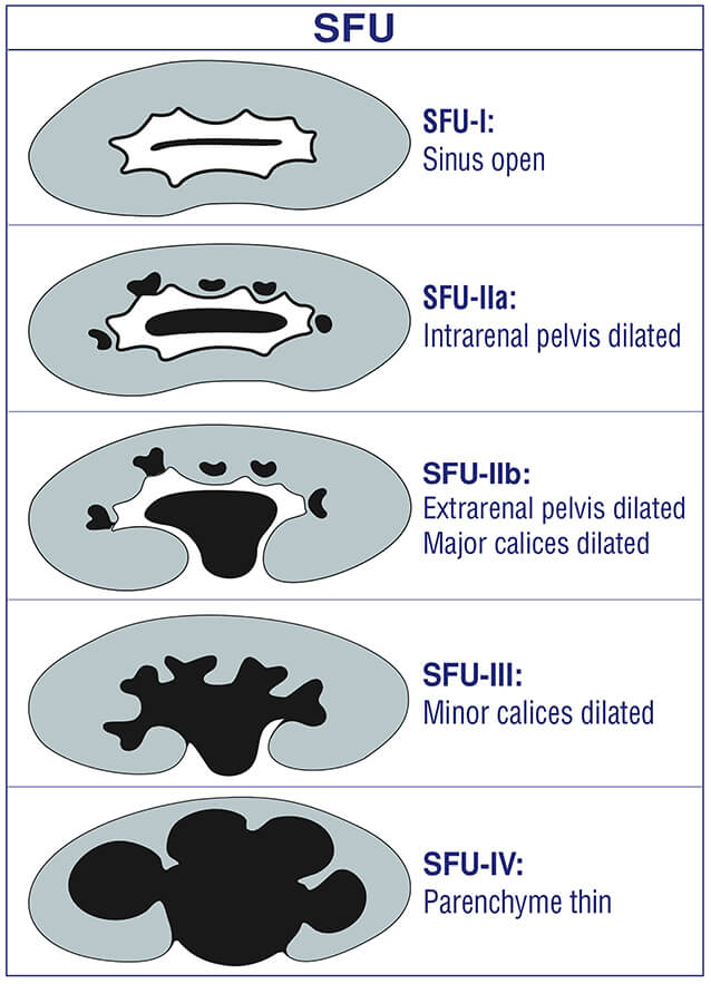 sfu classification