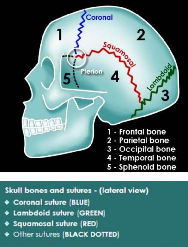 Skull sutures lateral
