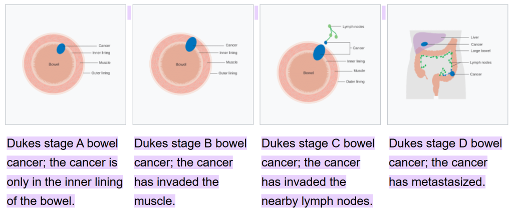 duke staging