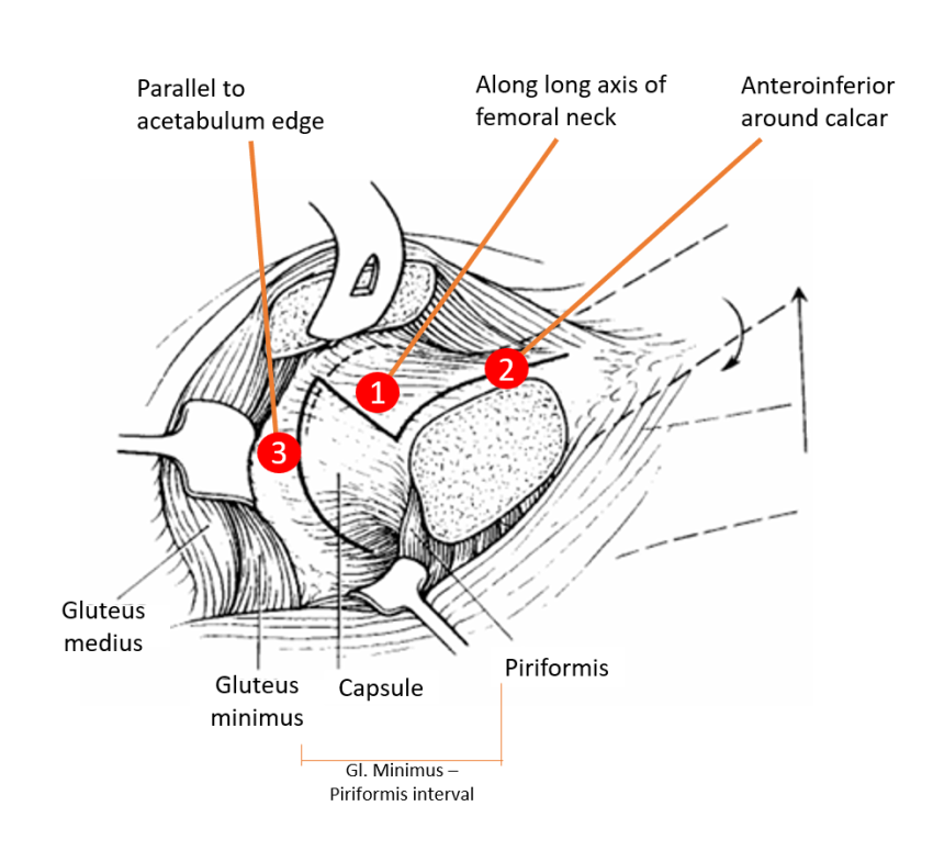 Aberdeen Knot | Epomedicine