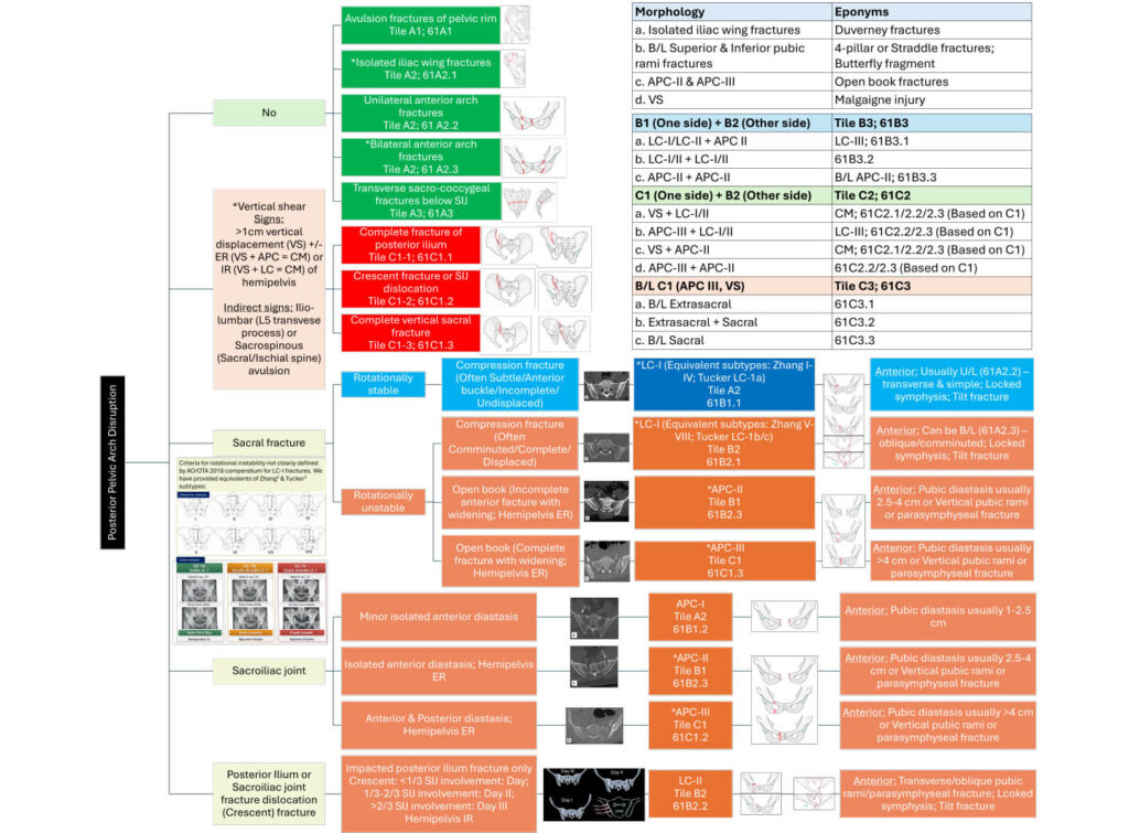 Pelvic ring injury classification algorithm